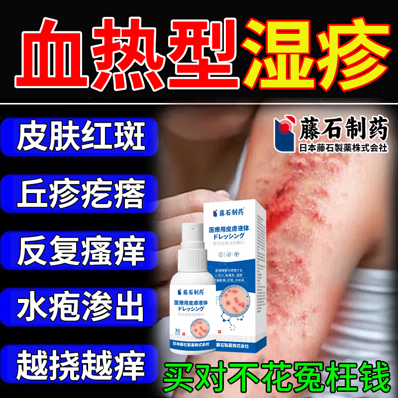 血热型湿疹止痒膏湿毒清