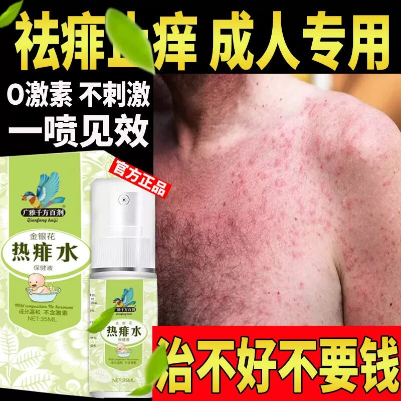 痱子水止痒成人去痱子喷雾液体祛痱膏治除热痱子水大人防菲神器药