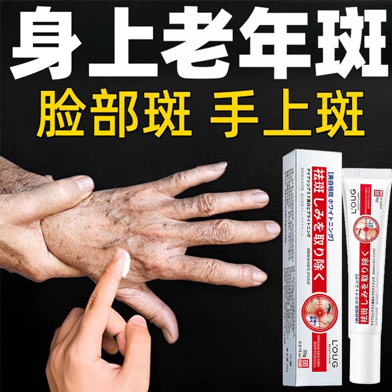 去黄色褐色斑老年斑膏专用强力手部脸部霜除黑班干燥粗糙