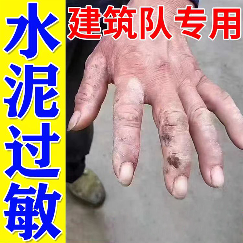 左大夫水泥过敏止痒药抑菌止痒膏