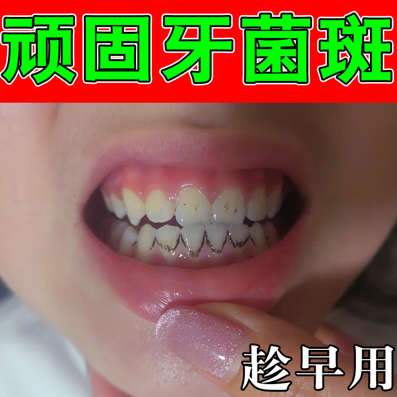 足掌跖手手干燥粗糙起皮脱皮干裂角质增厚泛红肌肤舒缓呵护软膏