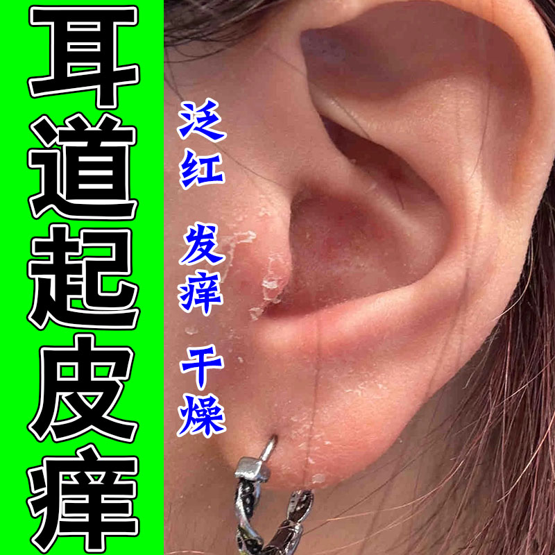 外耳道干痒耳朵痒外耳道干燥脱皮掉屑结痂草本修护乳膏
