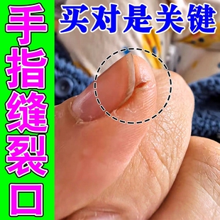 手裂口干裂修复霜秋冬季指甲缝干裂手指脱皮开裂手足干裂防皲裂膏