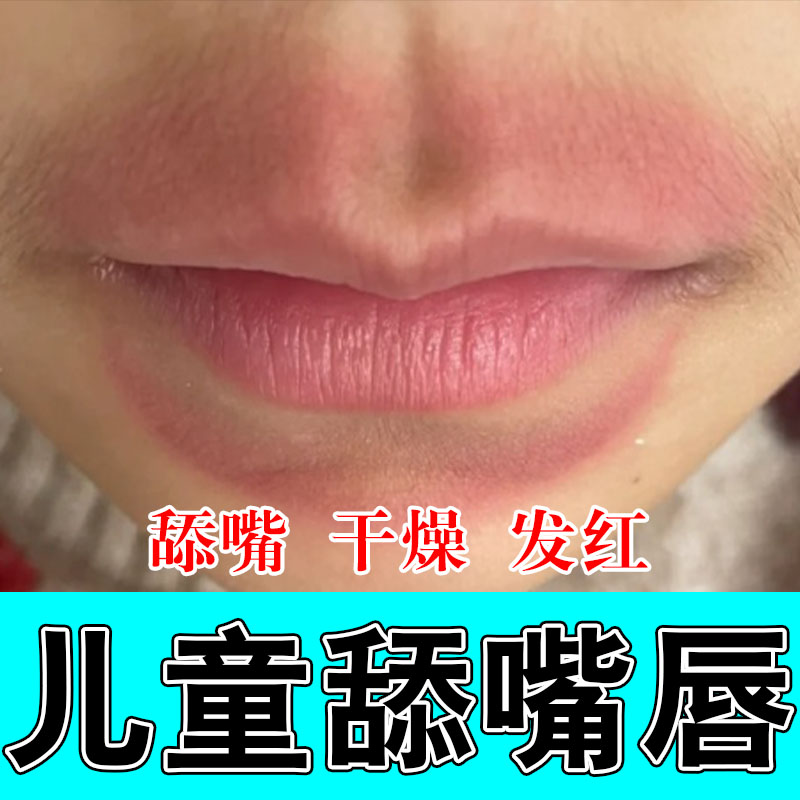 小孩唇周口周舔嘴泛红结痂干疼起皮粗糙不适草本润肤修护膏