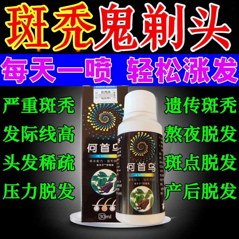 斑秃效特鬼剃头药生发剂快速生长增发男女专用激活毛囊育发精华液