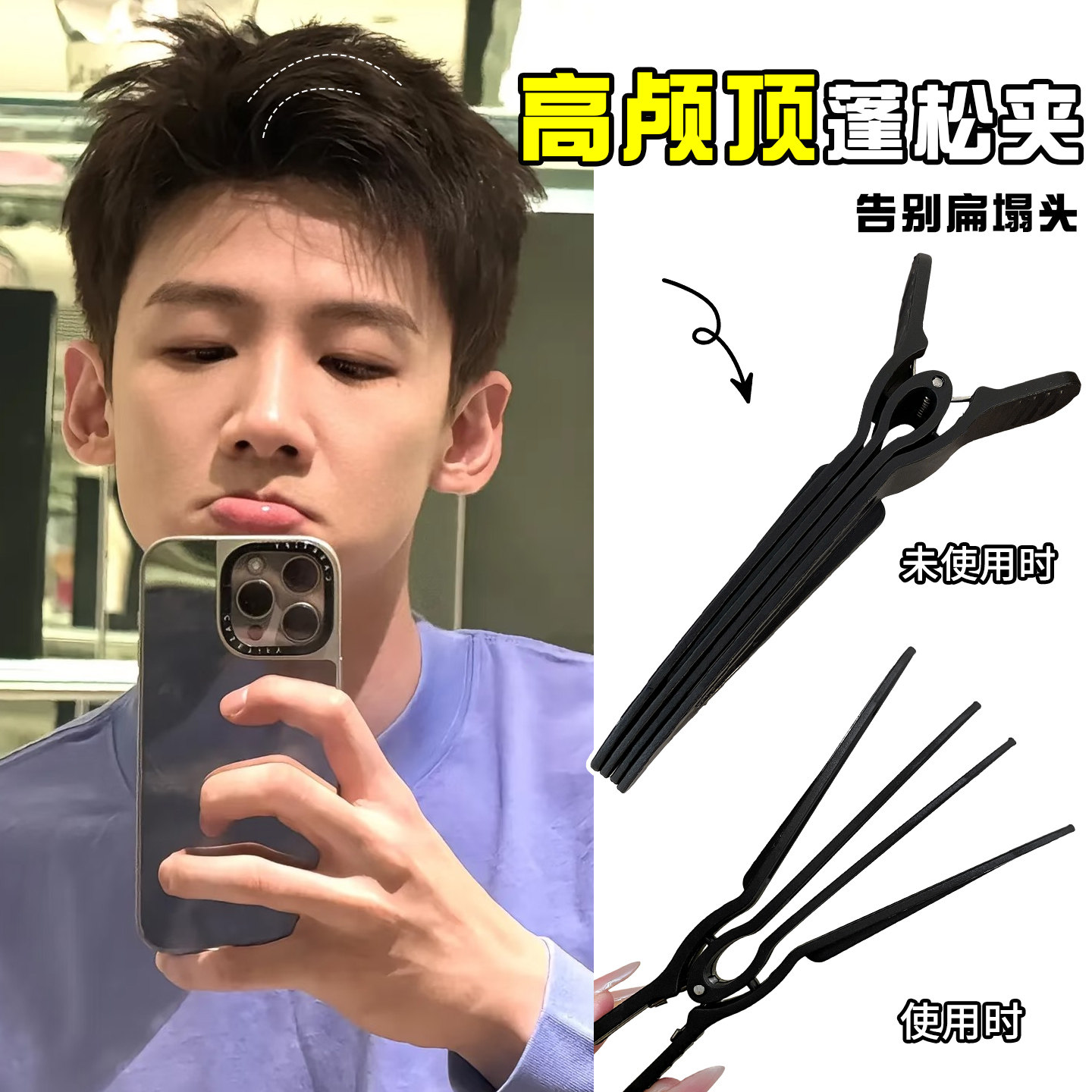 男士刘海蓬松夹定型夹定型神器头发无痕发夹高颅顶2026年发根固定