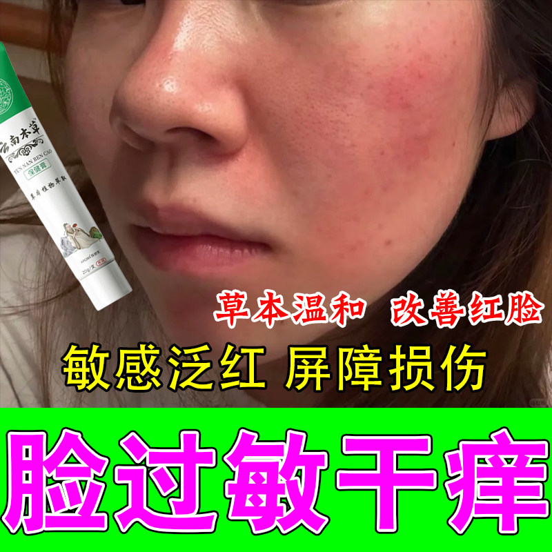 冶敏感脸上干燥起皮过敏发红脸部泛红敏感刺痛草本修护膏