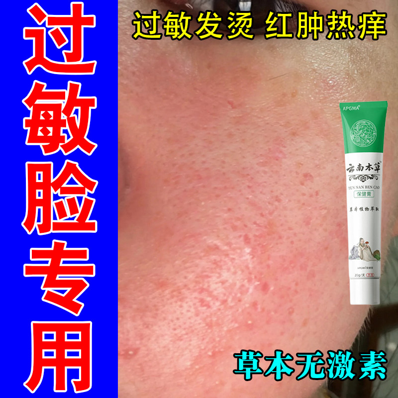 脸过敏干燥起皮起疙瘩发红痒皮肤过敏红热修护草本萃取膏