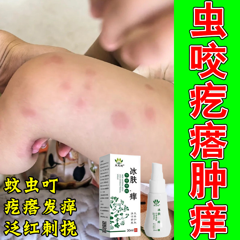 儿童疙瘩蚊虫叮咬跳蚤咬红痒虫蚊子叮咬红肿儿童疙瘩修护草本喷剂