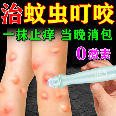 蚊虫叮咬止痒消肿药膏治婴儿童成人臭虫跳蚤蚊子去红肿黑印神器