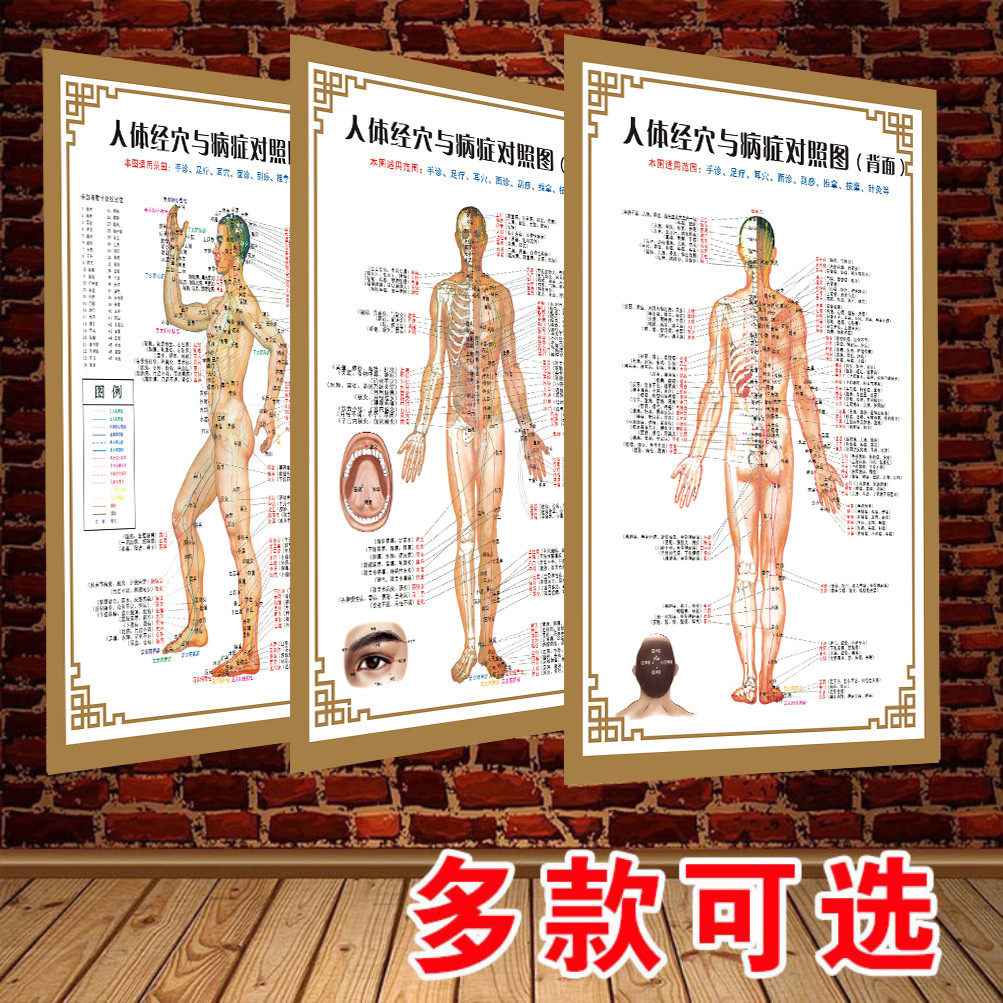 人体穴位图 全身图 中医针灸艾灸拔罐养生病症对照海报大挂图贴墙