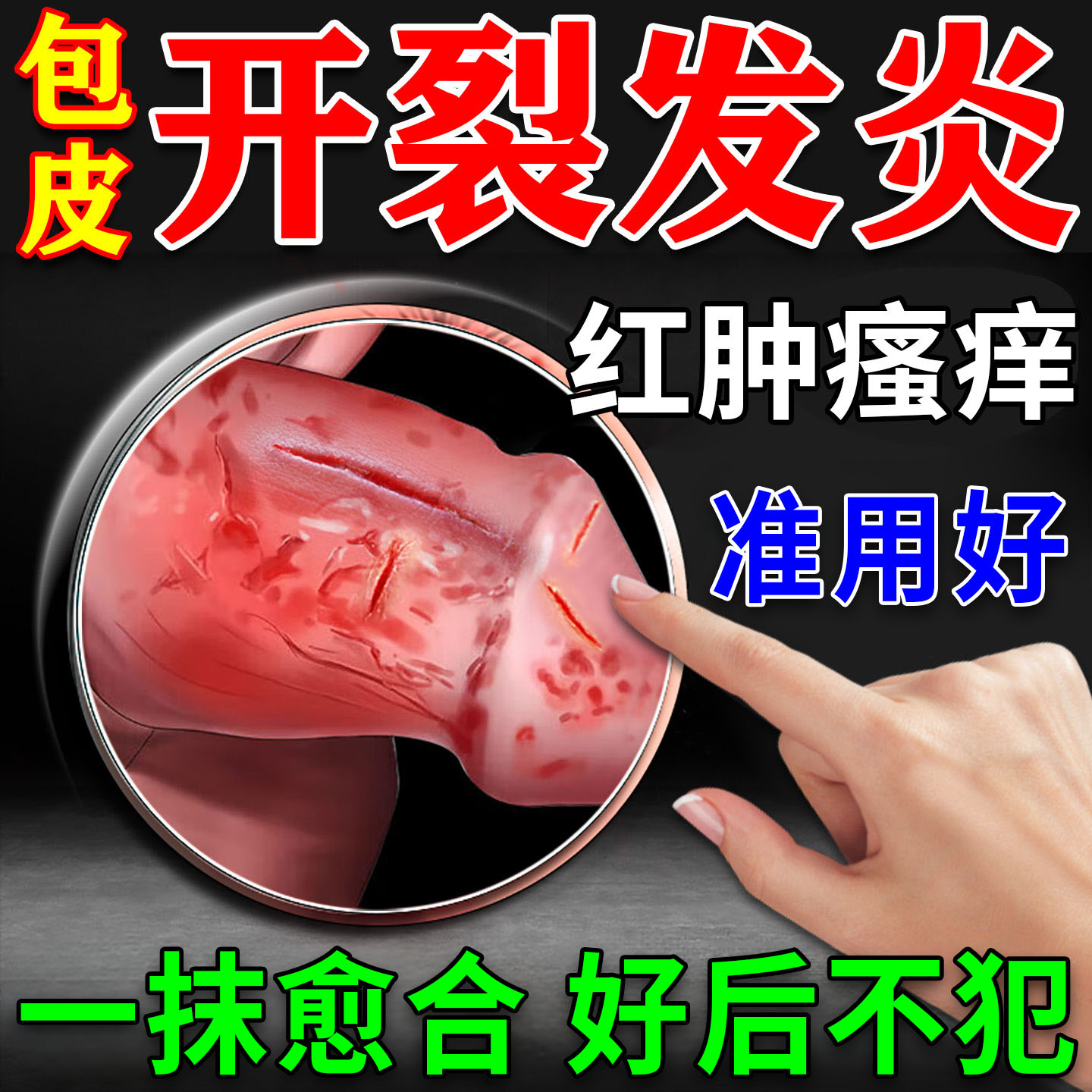 男性专用100%治疗包皮裂口秒愈合