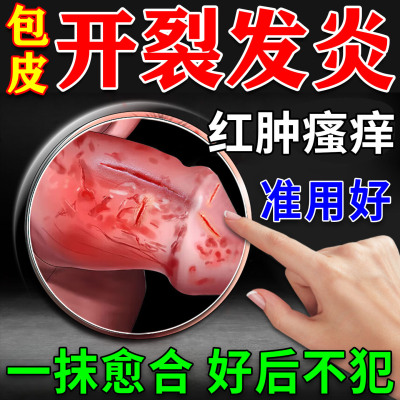 男性专用100%治疗包皮裂口秒愈合