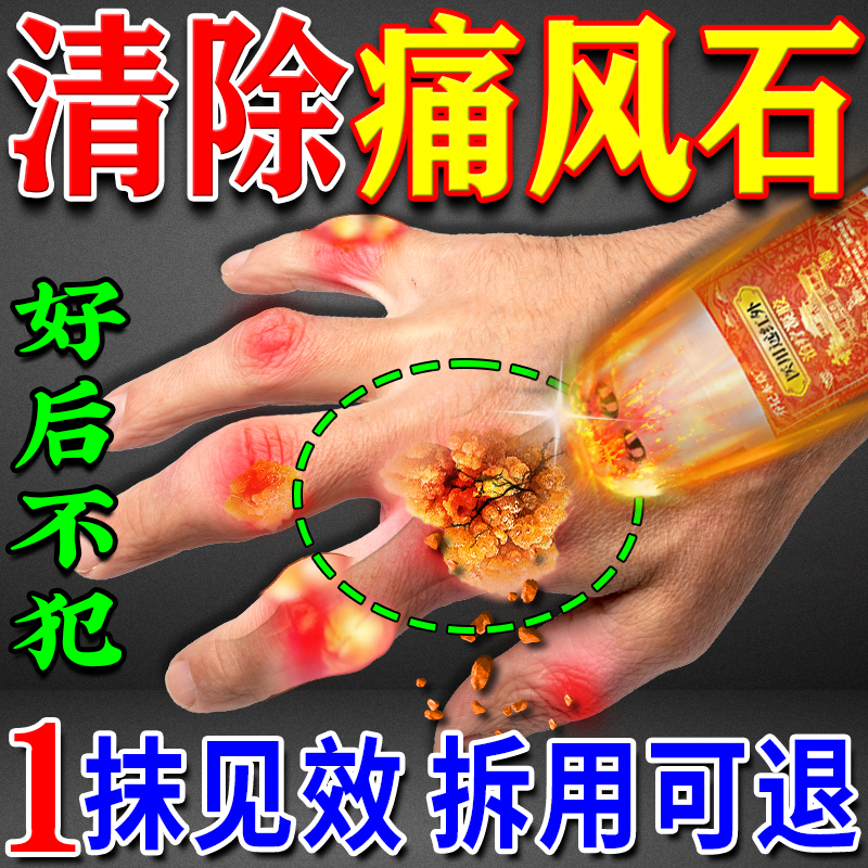 痛风降尿酸溶石去结晶效特贴膏药关节炎消除红肿止痛医用冷敷凝胶