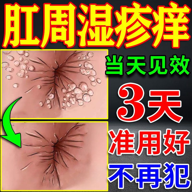 900%解决肛周湿疹问题