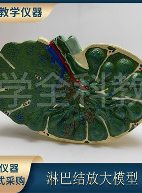 厂家直销淋巴结放大模型 生物医疗初高中教学模型 淋巴结放大展示