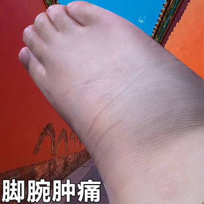 脚踝受伤崴脚走路神器扭伤脚踝热敷脚腕疼痛韧带拉伤恢复专用药膏