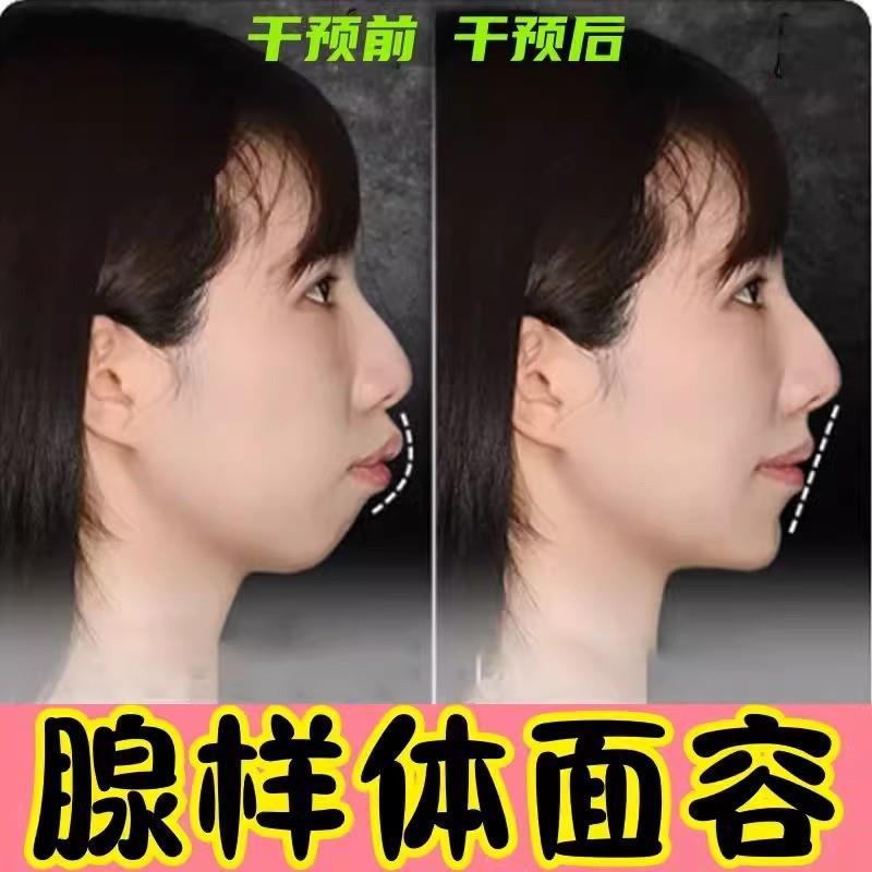 腺样体肥大面容矫正器调理儿童嘴唇上翘中药贴腺样体面容矫正克星