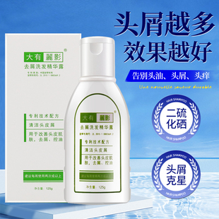 大有丽影去屑止痒洗发水乳露二硫化硒控油蓬松清爽官方旗舰店正品