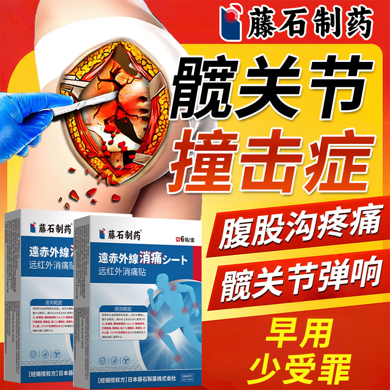 髋关节撞击综合症疼痛盂唇损伤滑膜炎脱臼股骨头坏死热敷膏药贴AH