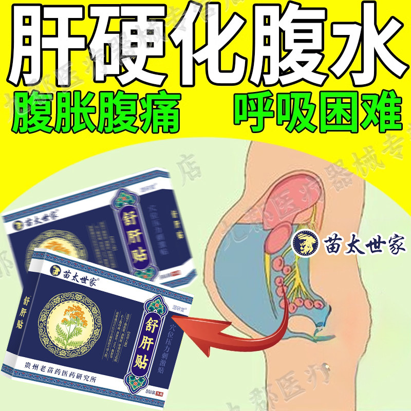 肝硬化腹水腹腔积液专用贴膏上腹疼痛腹胀腹泻脂肪肝舒肝贴AH