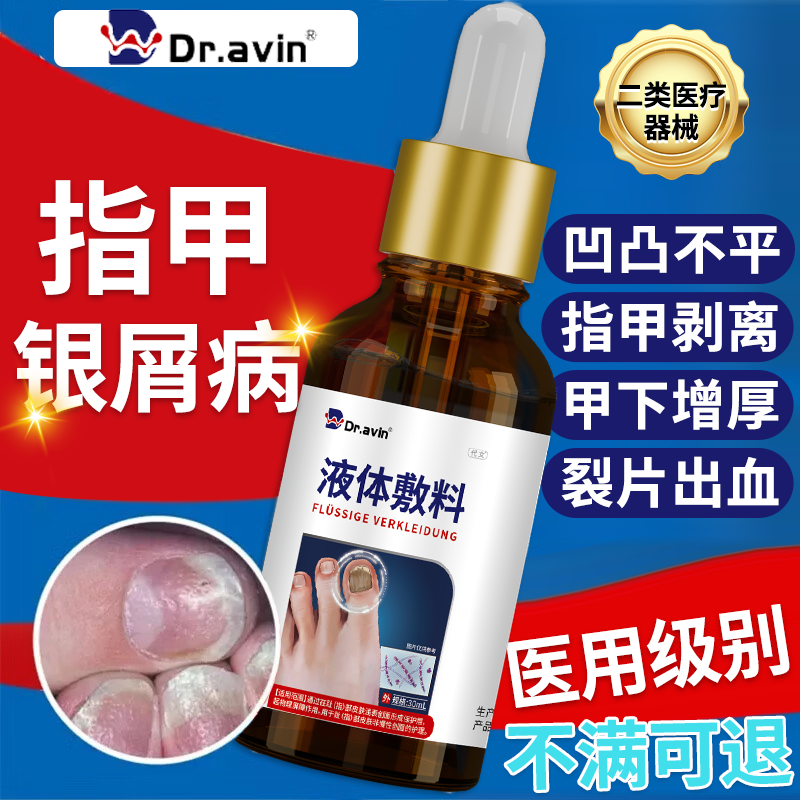 指甲银屑病凹凸不平指甲剥离甲下增厚裂片出血萎缩变白专用滴剂YK