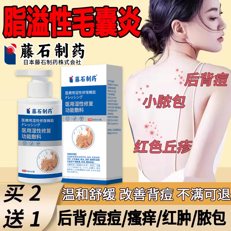 脂溢性皮炎毛囊炎专沐浴露后背痘红色丘疹小脓包疙瘩红肿疼痛用AH