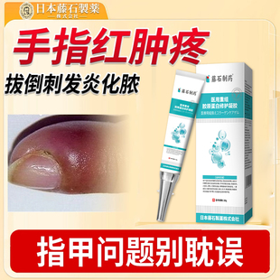 手指红肿疼拔倒刺化脓真菌感染专甲沟炎化脓消肿用正品AH