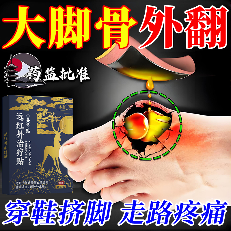 拇指外翻膏药贴大拇指疼痛专大脚骨关节畸形矫正拇囊炎用膏药贴AH