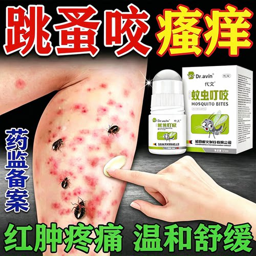 跳蚤咬止痒膏瘙痒红肿专儿童外用毒臭虫红蚂蚁皮肤过敏隐翅虫叮WJ