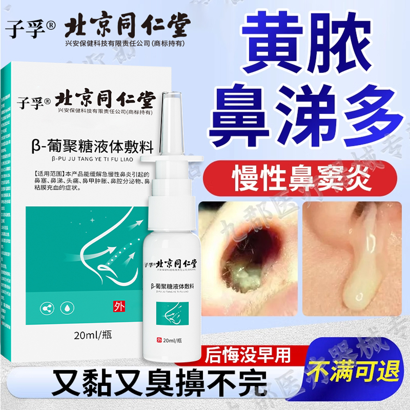 慢性鼻窦炎鼻塞鼻涕倒流鼻甲肥大头疼滴漏鼻炎鼻臭黄绿脓鼻涕多AH