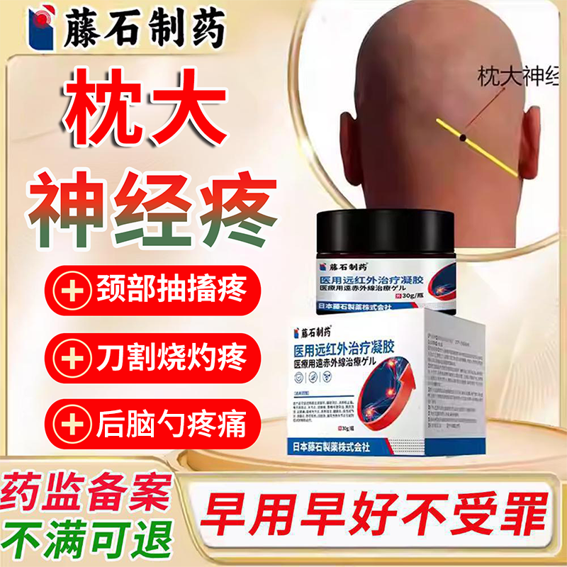枕大神经痛后脑针刺疼颈椎压迫神经痛偏头疼头皮后脑勺痛专用膏AH
