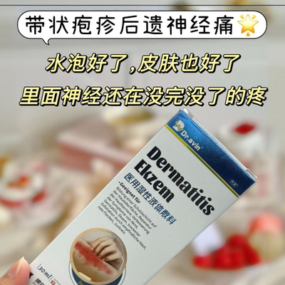 带状疱疹后遗神经痛外用凝胶