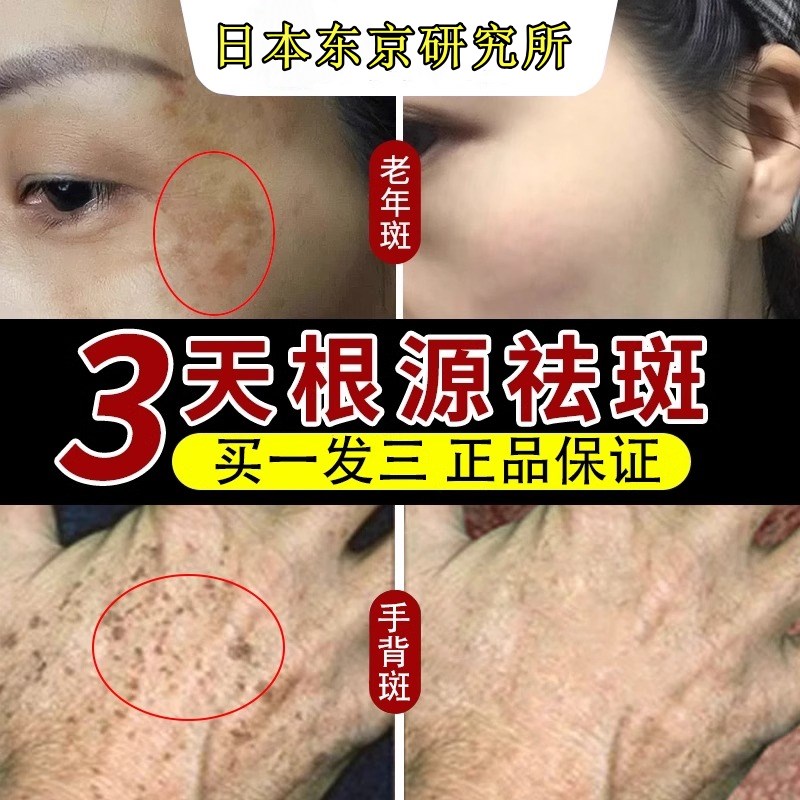 【日本の研發】全新升级 577VC衍生物 敏感肌 孕妇 .哺乳期可用