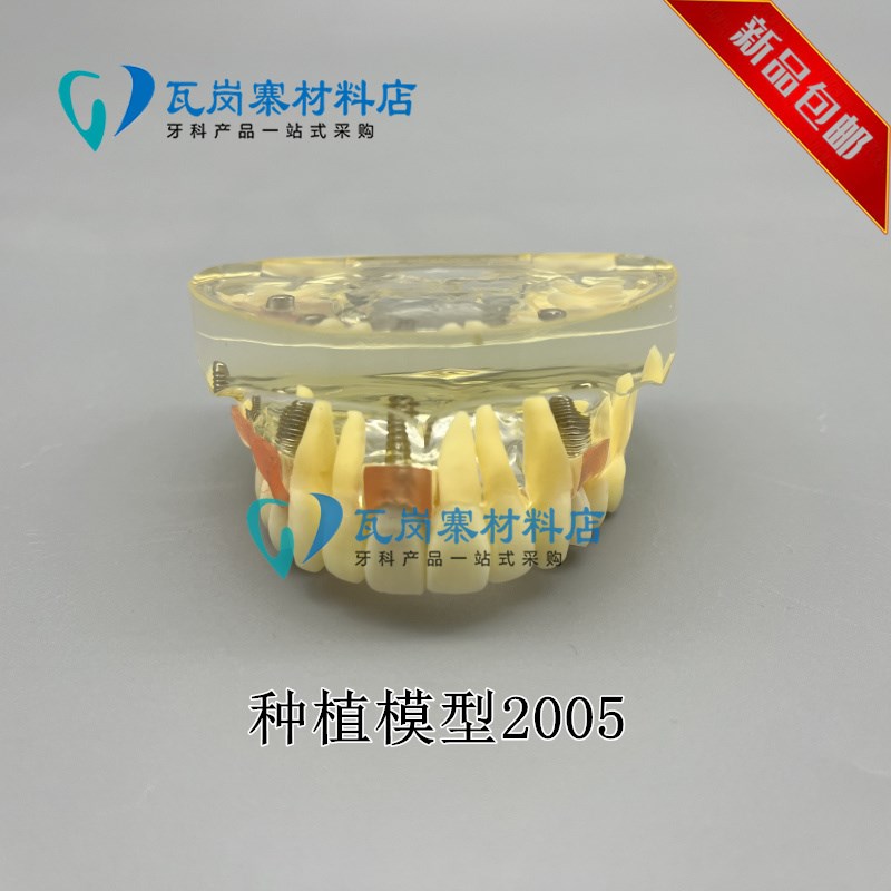 牙科模型口腔种植模型种植体解说义E齿修复对比种植钉球帽杆卡导