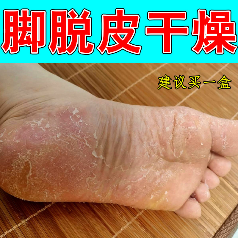 脚掌脱皮脚底脚心掉皮脱皮专用膏皮肤消毒护理（消）