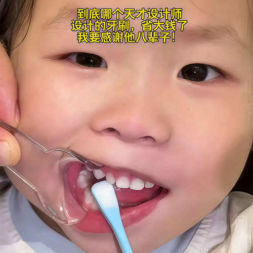 儿童刷牙辅助器开口器扩嘴工具