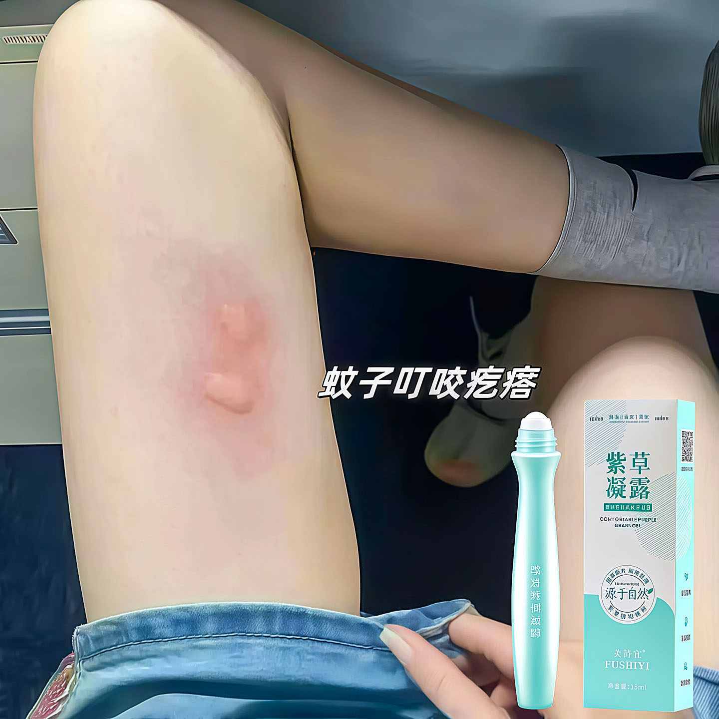 止痒驱蚊滚珠凝露蚊虫叮咬消包
