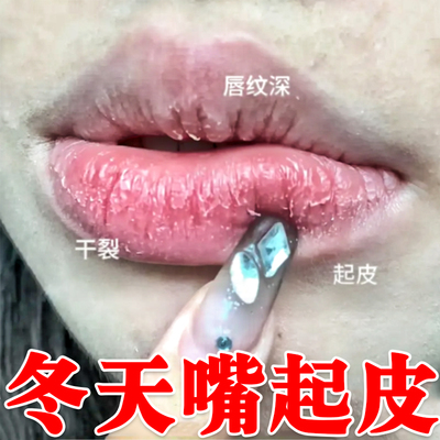 唇炎唇膏嘴唇干裂脱皮嘴巴干燥起硬皮去死皮唇纹男女士防裂润唇膏