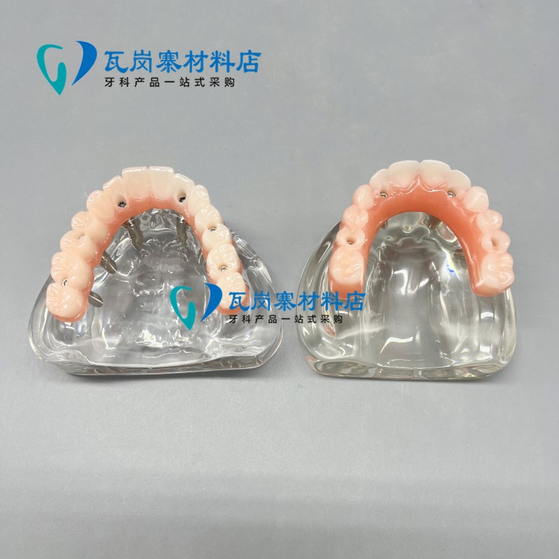 牙科口腔模型马龙连桥义r齿修复种植牙齿仿真演示模拟教学医患沟