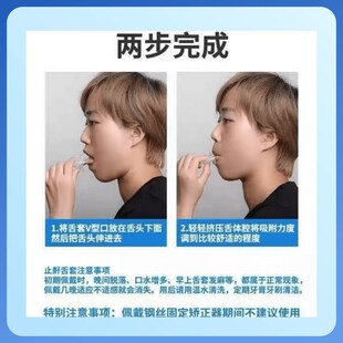 止鼾舌套防舌根后坠专用口腔矫正器物F理防打呼噜止鼾器口舌训练