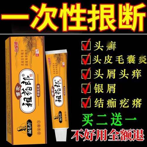 头癣药膏治头部头癣银屑癣头屑严重去屑止痒头皮屑癣头藓痒药去屑