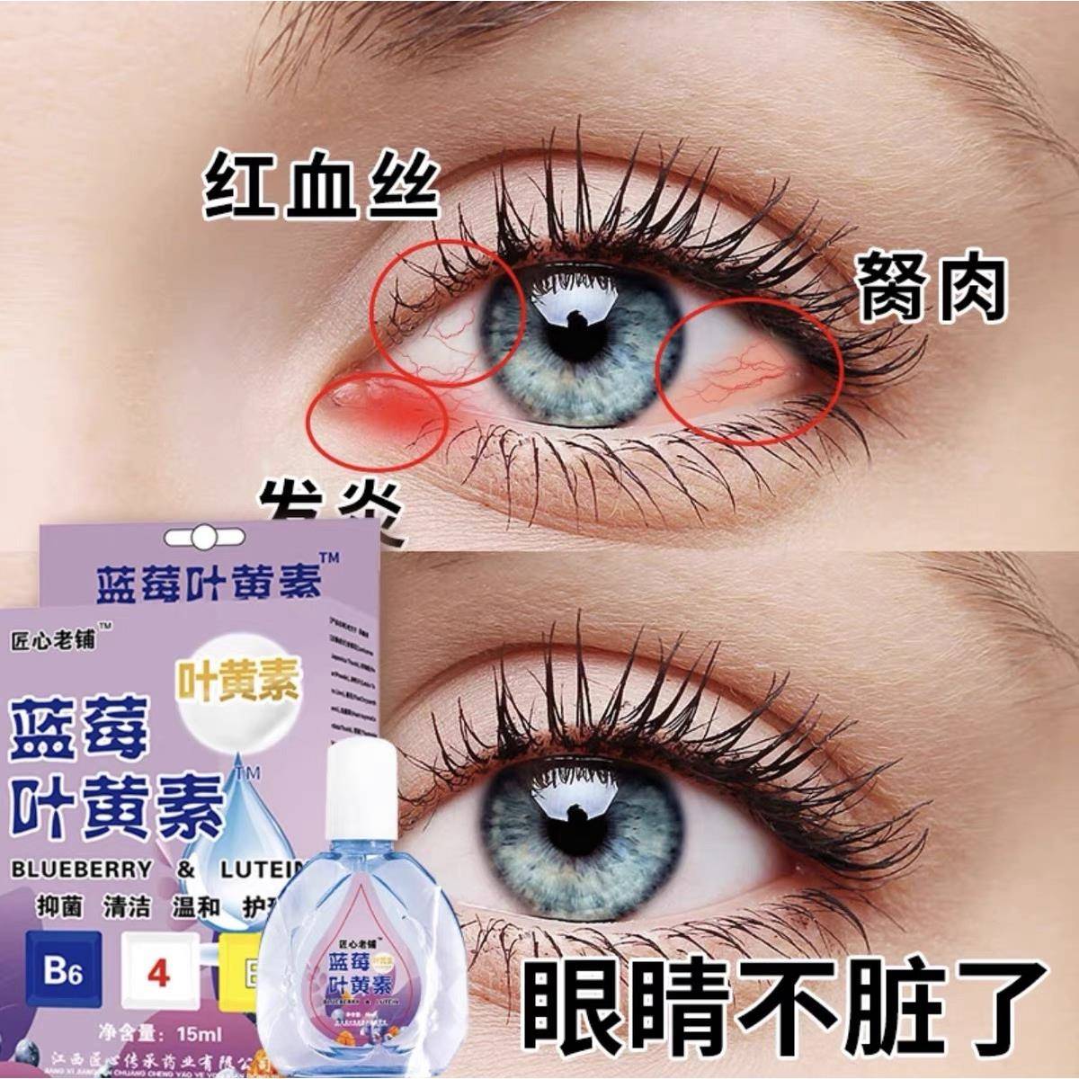 叶黄素滴眼液舒缓眼干眼疲劳止痒抗菌干涩闪亮蓝莓护理液明亮明目