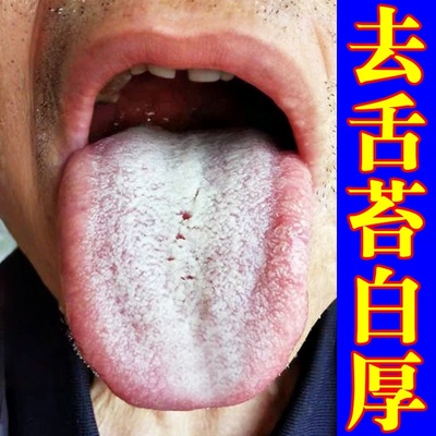 舌苔白厚发黄口臭喷剂去舌头黄腻调理口气口苦口干舌苔裂纹有齿痕
