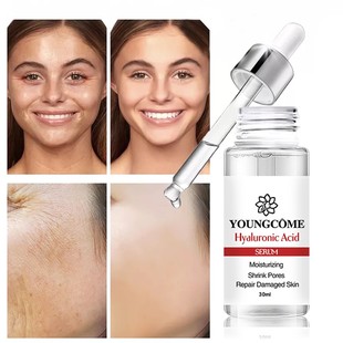 Essence Face Wrinkle Hyaluronic Aging Acid Anti 30ML Serum