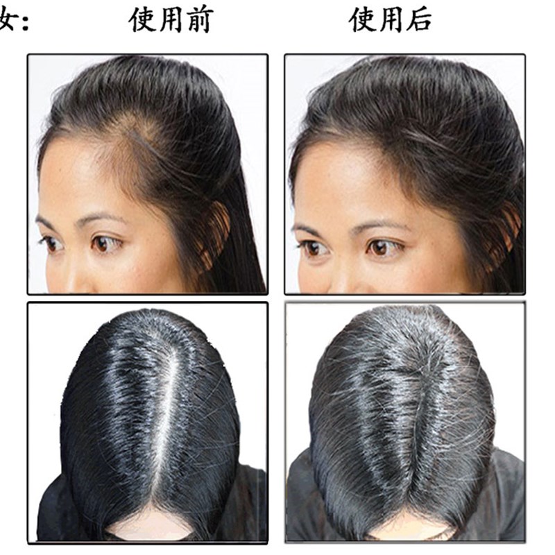 Dexe黑浓增发纤维假发美发粉浓密发宝补发男女头发快速密发多稀发