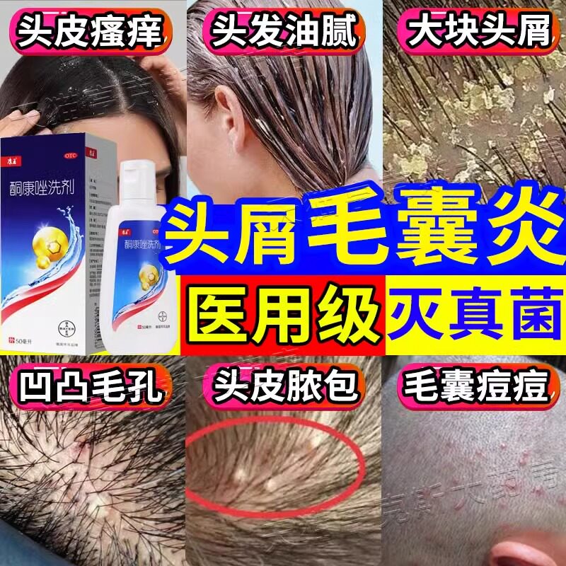 【康王】酮康唑洗剂2%*50ml/瓶