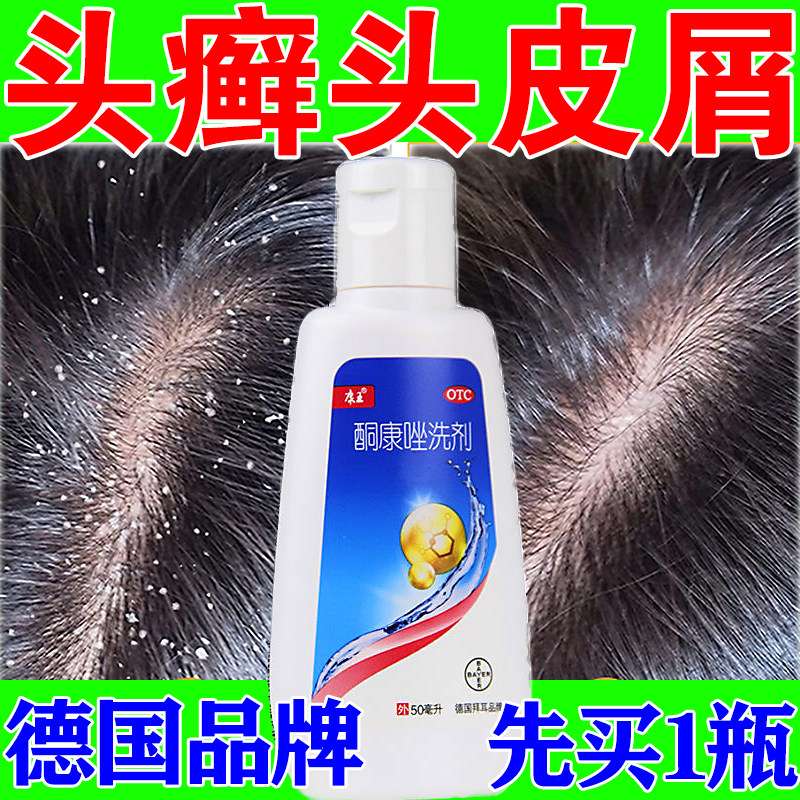 康王酮康唑洗剂头皮屑治疗药正品头皮痒脂溢性皮炎毛囊止痒去屑药