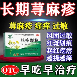 肤痒颗粒正品治疗荨麻疹荨麻疹过敏止痒皮肤瘙痒专用药