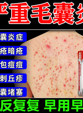 【福元】硝酸咪康唑乳膏2%*20g*1支/盒